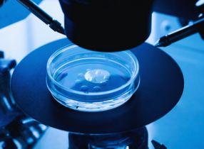 (IVM) نضوج البويضات خارج الجسم