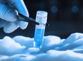 تجميدُ النطف